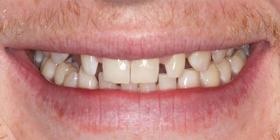 Улыбка до посещения ортопеда