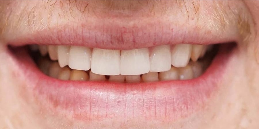 Улыбка после посещения ортопеда