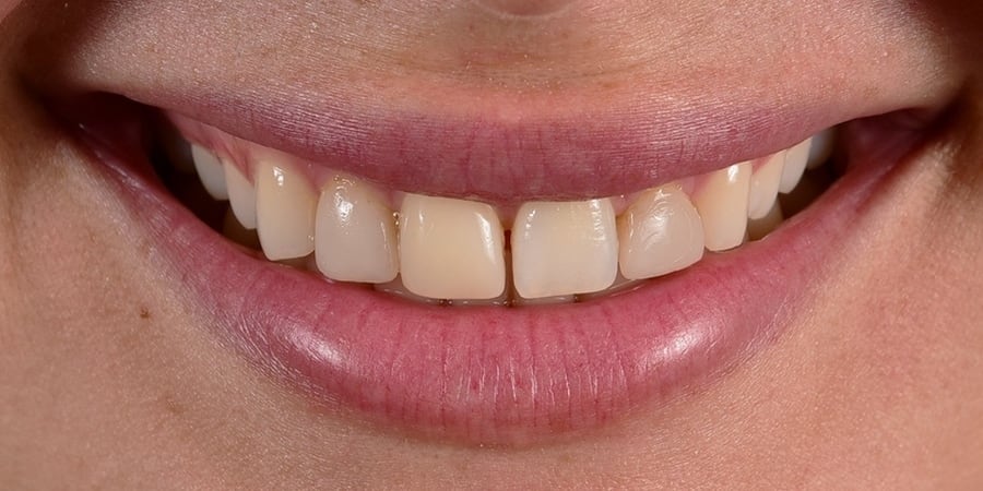 до ортопедического лечения