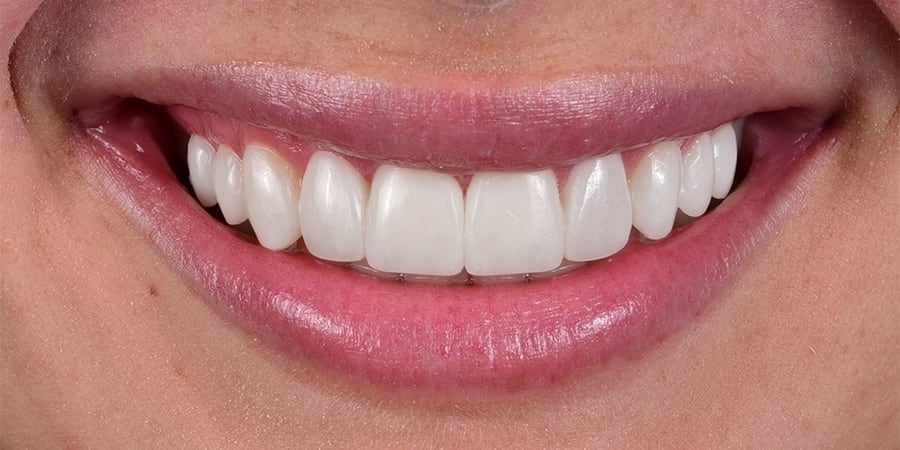 после ортопедического лечения